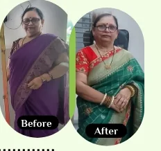 Kumud Upadhya before and after
