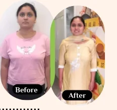 Neha before and after