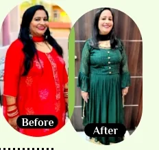 Poonam before and after