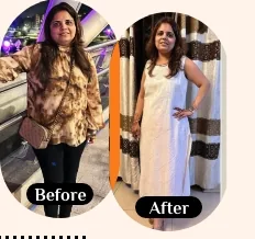 Sarita before and after