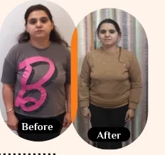 Shinky Gupta before and after